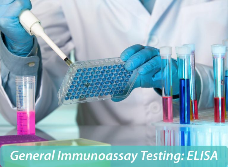 General Immunoassay Testing: ELISA - Elokarsa